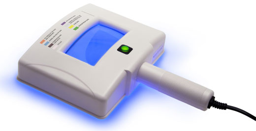 L&aacute;mpara de Wood