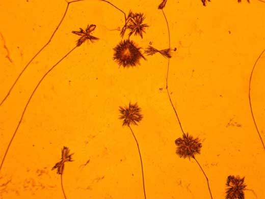 An&aacute;lisis Histol&oacute;gico