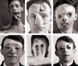 La Primera Guerra Mundial y la cirug�a pl�stica