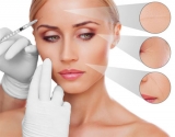Aplicaci�n de PRP en rejuvenecimiento facial: preguntas y respuestas