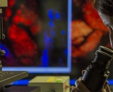 La microscop�a multifot�n llega a la est�tica: una nueva era en rejuvenecimiento cut�neo?